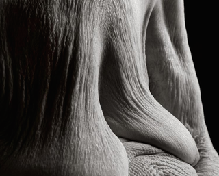 Illustration for article titled What the human body looks like at 100 years old